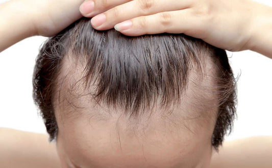 caduta capelli primavera