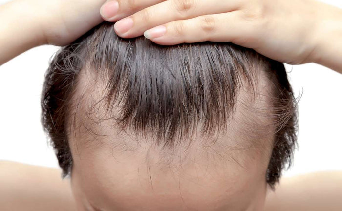 Caduta stagionale dei capelli e ciclo del capello